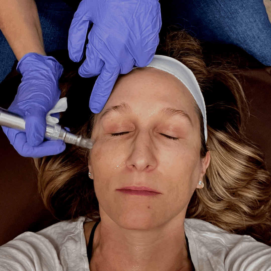 Micro+ Pen TOMA Essential Skin Therapy
